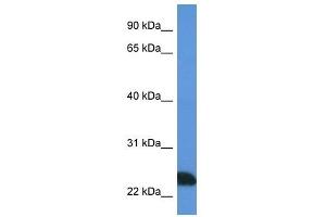 Western Blot showing PRSS1 antibody used at a concentration of 1 ug/ml against Jurkat Cell Lysate