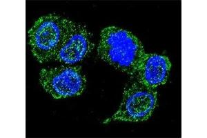 Confocal immunofluorescent analysis of JNK1 antibody with HepG2 cells followed by Alexa Fluor 488-conjugated goat anti-rabbit lgG (green). (JNK Antikörper  (AA 358-389))