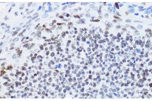 Immunohistochemistry (Paraffin-embedded Sections) (IHC (p)) image for anti-Histone H4 (acLys12) antibody (ABIN7257734)