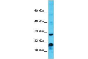 Host: Rabbit Target Name: MS4A6E Sample Type: Jurkat Whole Cell lysates Antibody Dilution: 1. (MS4A6E Antikörper  (Middle Region))