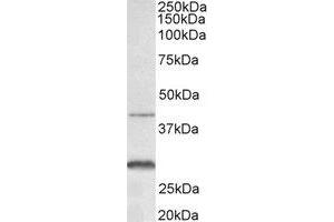 Western Blotting (WB) image for anti-Chemokine (C-X-C Motif) Receptor 2 (CXCR2) (N-Term) antibody (ABIN2465048) (CXCR2 Antikörper  (N-Term))