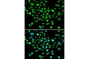 Immunofluorescence analysis of MCF-7 cells using PRK antibody (ABIN6132517, ABIN6146187, ABIN6146188 and ABIN6223135). (PRKAG1 Antikörper  (AA 1-331))