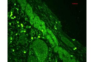 Immunohistochemistry analysis using Rabbit Anti-Rab4 Polyclonal Antibody . (Rab4 Antikörper  (C-Term) (HRP))