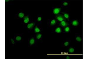 Immunofluorescence of monoclonal antibody to OXSR1 on HeLa cell. (OXSR1 Antikörper  (AA 1-527))