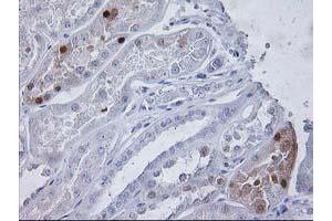 Immunohistochemical staining of paraffin-embedded Human Kidney tissue using anti-PGAM2 mouse monoclonal antibody. (PGAM2 Antikörper)