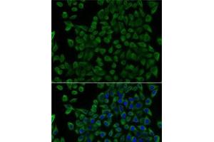 Immunofluorescence analysis of U2OS cells using TCN2 Polyclonal Antibody (TCN2 Antikörper)