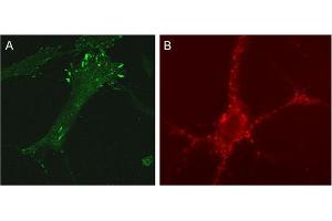 A: Indirect immunolabeling of NHF cells (dilution 1 : 100). (SDCBP Antikörper)
