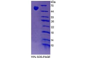 SDS-PAGE (SDS) image for Phenylalanine-tRNA Synthetase 2 (Mitochondrial) (FARS2) (AA 1-472) protein (His tag) (ABIN4989671)