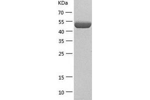 Western Blotting (WB) image for CNDP Dipeptidase 2 (Metallopeptidase M20 Family) (CNDP2) (AA 1-475) protein (His tag) (ABIN7288398) (CNDP2 Protein (AA 1-475) (His tag))