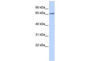 Image no. 1 for anti-Zinc Finger Protein 192 (ZNF192) (C-Term) antibody (ABIN6742803) (ZNF192 Antikörper  (C-Term))