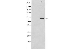 Western blot analysis of PAK1 phosphorylation expression in etoposide treated 293 whole cell lysates,The lane on the left is treated with the antigen-specific peptide. (PAK1 Antikörper  (pThr212))