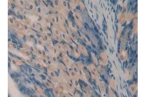 Detection of OCM in Mouse Stomach Tissue using Polyclonal Antibody to Oncomodulin (OCM) (Oncomodulin Antikörper  (AA 1-109))