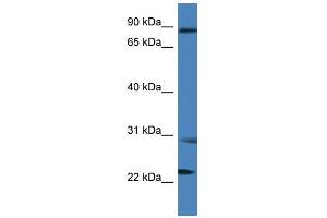 WB Suggested Anti-MIA2 Antibody Titration: 1. (MIA2 Antikörper  (C-Term))