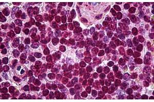 Human Spleen: Formalin-Fixed, Paraffin-Embedded (FFPE) (SOX10 Antikörper)