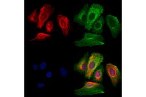 ABIN6265630 and ABIN6266708 staining Hela cells by IF/ICC.
