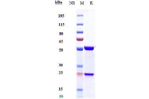 Anti-IL-6 / IFNb2 Reference Antibody (siltuximab) on SDS-PAGE under reducing (R) condition. (Rekombinanter IL6 (Siltuximab Biosimilar) Antikörper)