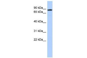 WB Suggested Anti-LOC81691 Antibody Titration: 0. (LOC81691 Antikörper  (Middle Region))