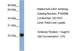 WB Suggested Anti-CAV1  Antibody Titration: 0. (Caveolin-1 Antikörper  (N-Term))