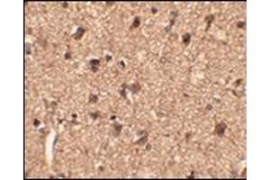 Immunohistochemistry of Slitrk1 in human brain tissue with this product at 2. (SLITRK1 Antikörper  (Middle Region))