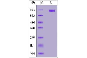 MERS S1 protein, His Tag on  under reducing (R) condition.
