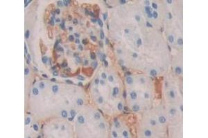Used in DAB staining on fromalin fixed paraffin- embedded kidney tissue (Uroplakin 3A Antikörper  (AA 15-212))
