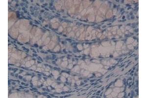 Detection of HDC in Mouse Colon Tissue using Polyclonal Antibody to Histidine Decarboxylase (HDC)