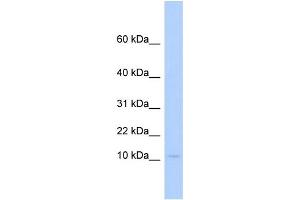 WB Suggested Anti-PLAC9 Antibody Titration:  0. (PLAC9 Antikörper  (Middle Region))