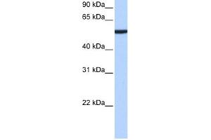WB Suggested Anti-CBX2 Antibody Titration:  0.