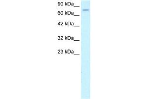 WB Suggested Anti-ZFP95 Antibody Titration: 1. (ZKSCAN5 Antikörper  (N-Term))