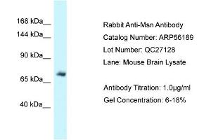 Western Blotting (WB) image for anti-Moesin (MSN) (C-Term) antibody (ABIN971193) (Moesin Antikörper  (C-Term))