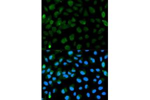Immunofluorescence analysis of HeLa cell using PML antibody. (PML Antikörper  (AA 300-600))