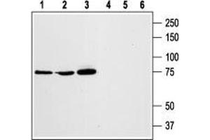Western blot analysis of rat RBL basophilic leukemia (lanes 1 and 4), human HL-60 promyelocytic leukemia (lanes 2 and 5), and human Jurkat T-cell leukemia (lanes 3 and 6) cell lysates: - 1,2,3. (STIM1 Antikörper  (Extracellular, N-Term))