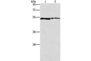 Western Blot analysis of A549 and Mouse eye tissue using ALDH3A1 Polyclonal Antibody at dilution of 1:750 (ALDH3A1 Antikörper)