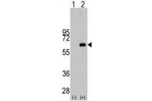 Image no. 1 for anti-Myc Proto-Oncogene protein (MYC) antibody (ABIN357362) (c-MYC Antikörper)