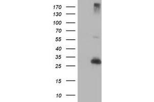 Western Blotting (WB) image for anti-Regulatory Factor X-Associated Ankyrin Containing Protein (RFXANK) antibody (ABIN1500679) (RFXANK Antikörper)