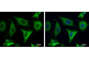ICC/IF Image Fatty Acid Synthase antibody [N1N2], N-term detects Fatty Acid Synthase protein at cytoplasm by immunofluorescent analysis. (Fatty Acid Synthase Antikörper  (N-Term))
