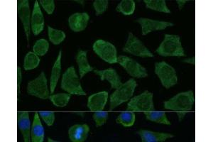Immunofluorescence analysis of L929 cells using FKBP1B Polyclonal Antibody at dilution of 1:100 (40x lens). (FKBP1B Antikörper)