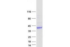 Validation with Western Blot (MADCAM1 Protein (Transcript Variant 2) (Myc-DYKDDDDK Tag))