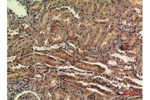 Immunohistochemistry (IHC) analysis of paraffin-embedded Human Kidney, antibody was diluted at 1:100. (SDHB Antikörper  (Internal Region))