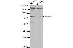 Western blot analysis of extracts of various cell lines, using EPXH2 antibody. (EPHX2 Antikörper)