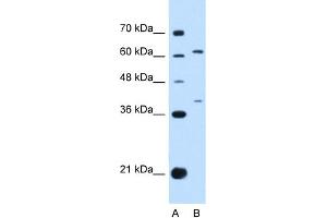 Western Blotting (WB) image for anti-Interleukin 28 Receptor, alpha (Interferon, lambda Receptor) (IL28RA) (N-Term) antibody (ABIN2783215)