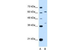 WB Suggested Anti-IL28RA Antibody Titration:  0.