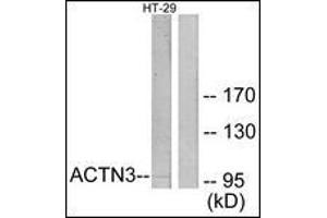 Western blot analysis of extracts from HT-29 cells, using ACTN3 Antibody. (ACTN3 Antikörper  (N-Term))