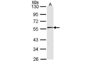 WB Image Sample (30 ug of whole cell lysate) A: IMR32 10% SDS PAGE antibody diluted at 1:1000 (STK26/MST4 Antikörper  (C-Term))