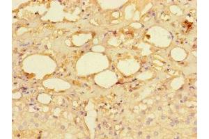 Immunohistochemistry of paraffin-embedded human adrenal gland tissue using ABIN7142262 at dilution of 1:100 (MRPS28 Antikörper  (AA 72-187))