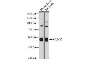Western blot analysis of extracts of various cell lines, using C antibody (ABIN3021053, ABIN3021054, ABIN3021055 and ABIN6213930) at 1:1000 dilution. (ACVR1C/ALK7 Antikörper  (AA 22-113))