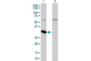 Western Blot analysis of MLF2 expression in transfected 293T cell line by MLF2 monoclonal antibody (M01), clone 2F6-1E3. (MLF2 Antikörper  (AA 1-248))
