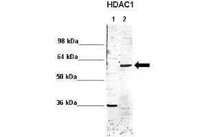 WB Suggested Anti-HDAC1 Antibody  Positive Control: Lane 1: 5ug mouse brain cytoplasm Lane 2: 5ug mouse brain nucleus  Primary Antibody Dilution :  1:1000 Secondary Antibody : Anti rabbit - IR-dye Secondry Antibody Dilution :  1:10,000  Submitted by: Anonymous