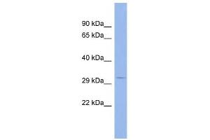 MSI2 antibody used at 1 ug/ml to detect target protein. (MSI2 Antikörper)