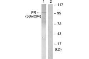 Western blot analysis of extracts from 293 cells treated with Etoposide 25uM 60', using Progesterone Receptor (Phospho-Ser294) Antibody. (Progesterone Receptor Antikörper  (pSer294))